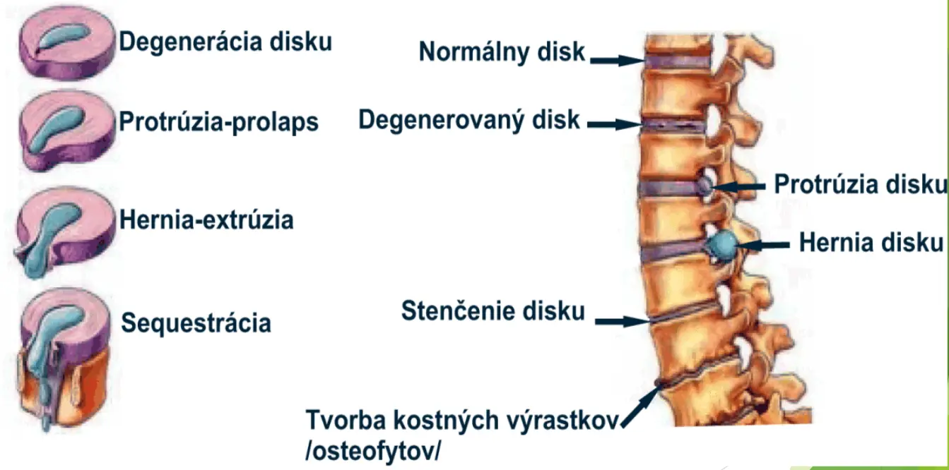 PRT pod CT kontrolou