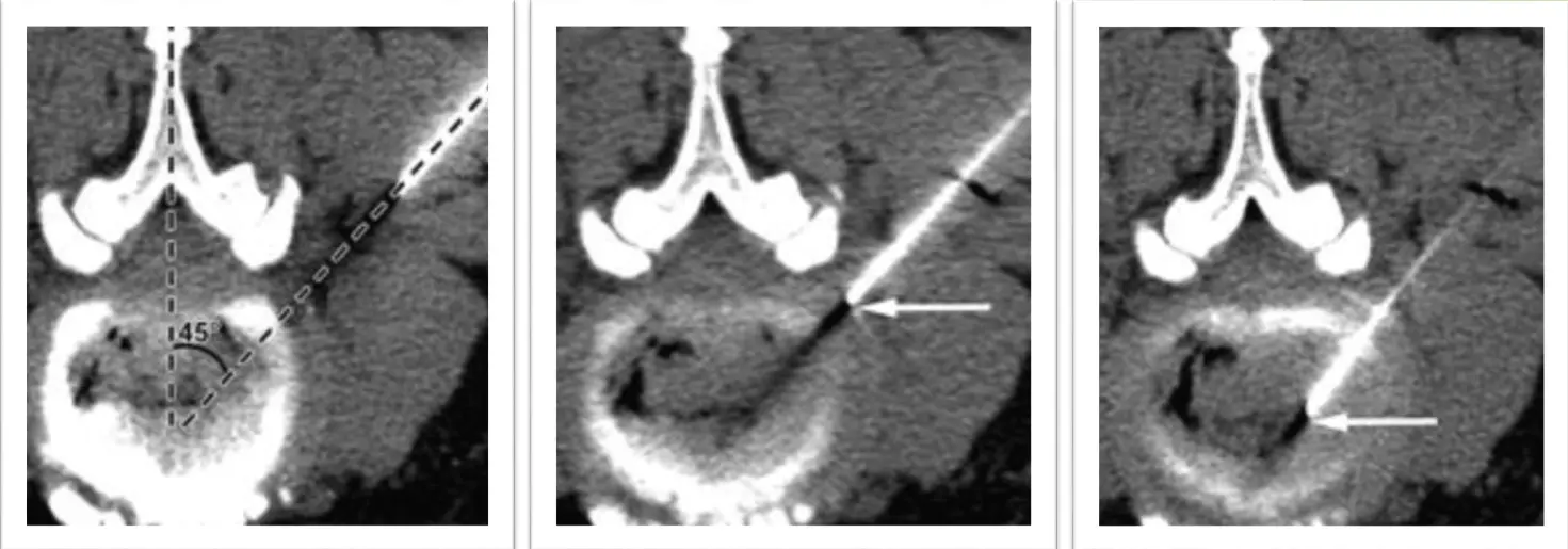 Kontrola liečebnej zmesi